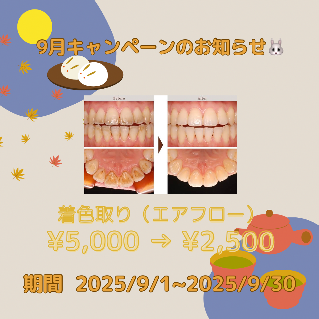 9月のキャンペーン🐰