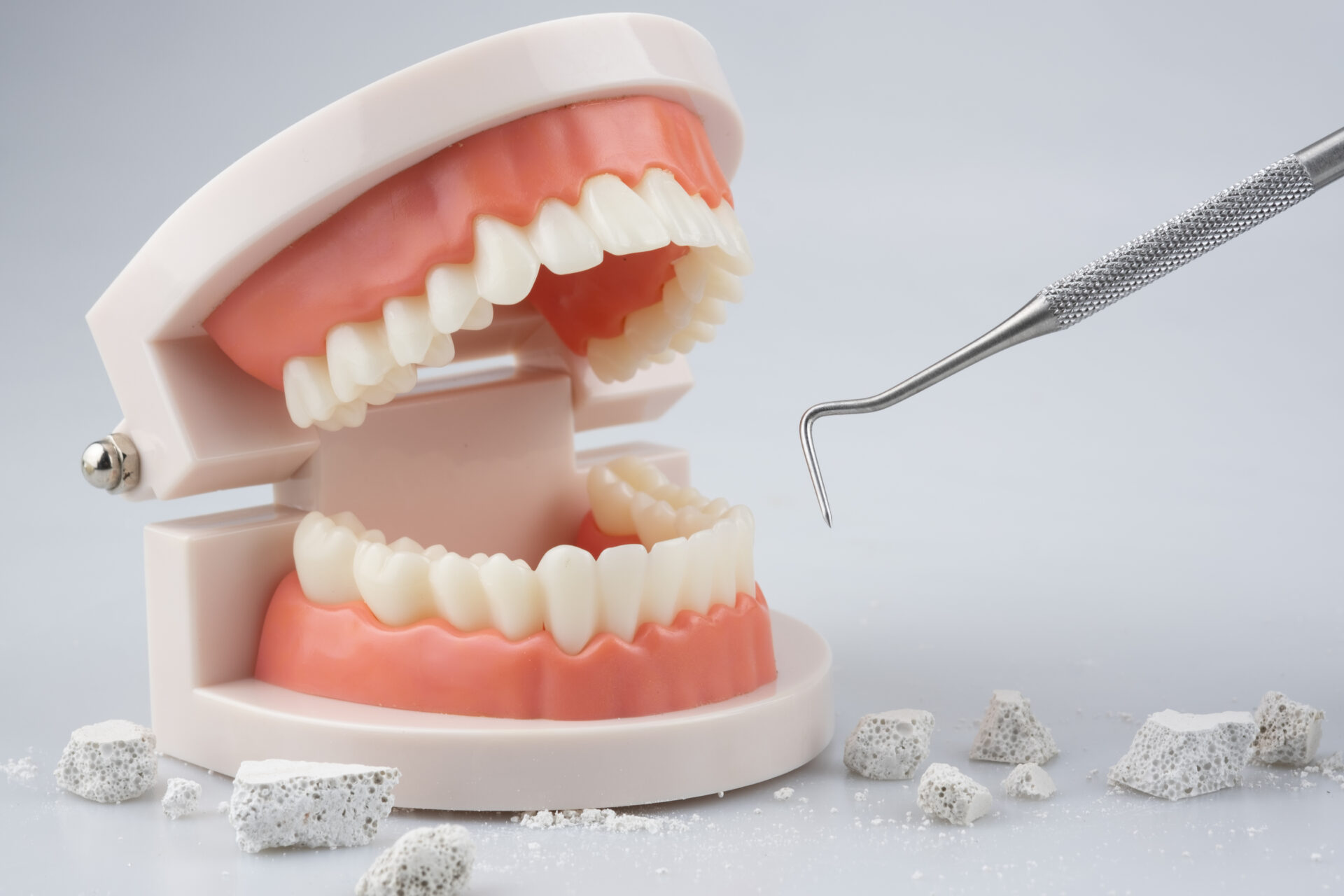 定期検診、実は○ヶ月以上空けると損してます