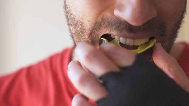 スポーツマウスピースが必要な方へ