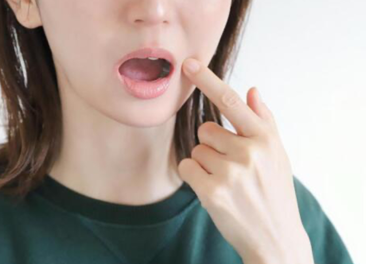 歯茎の腫れの原因と正しい対処法