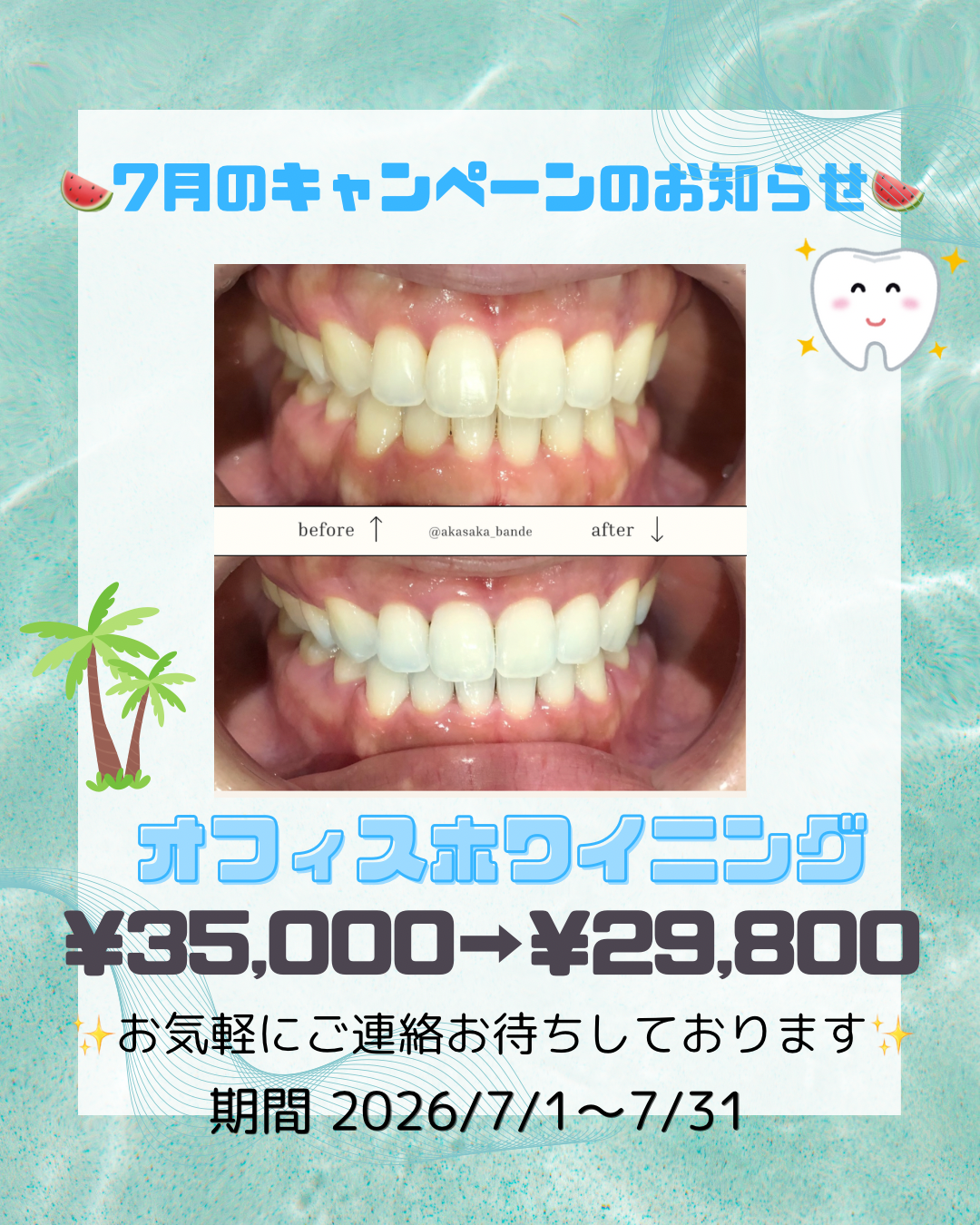 7月のキャンペーン🍉